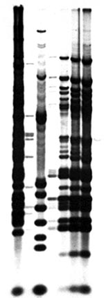 Thumbnail of Restriction fragment-length polymorphism analysis for isolates from patients and hot tub. Lane 1: Mycobacterium avium CDC #91-9282, serotype 4. Lane 2: M. avium CDC #91-9285, serotype 10. Lane 3: M. avium CDC #91-9299, serotype 8. Lane 4: Hot tub isolate. Lane 5: Isolate from Patient 2. Lane 6: Isolate from Patient 3. Lane 7: Isolate from Patient 1.