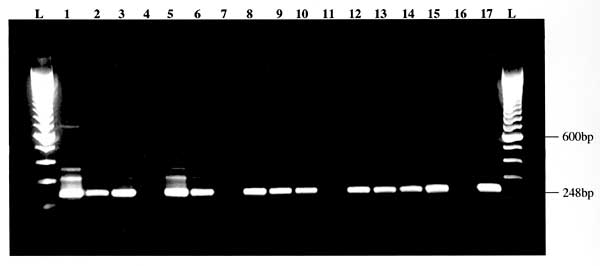 Visualization of reverse transcription-nested polymerase chain reaction product. West Nile virus-positive samples are indicated by a 248-bp band. Lane 1: positive crow brain, NY, 1999. Lane 2: positive crow kidney, NY, 1999. Lane 3: positive Sandhill Crane brain, CT, 1999. Lane 4: negative crow brain. Lane 5-6: positive crow brains, NY, 2000. Lane 7: normal control. Lane 8-10: positive horse brains, NY, 1999. Lane 11: negative horse brain. Lane 12: positive horse brain, RI, 2000. Lane 13: positi