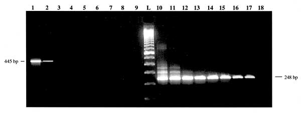 Visual comparison of first stage reverse transcription-polymerase chain reaction (RT-PCR) amplification products with RT-nested (n) PCR amplification products. Lanes 1-9 represent first-stage products of 10-fold dilutions 10-1 through 10-9. Lanes 10-18 represent nested amplification products of same dilutions. L: 100-bp DNA ladder.