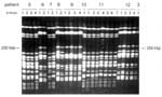 Thumbnail of Pulsed-field gel electrophoresis of XbaI macrorestriction fragments for the ciprofloxacin-resistant Enterobacter cloacae strains. Examples of different sets of patient isolates are shown. The interpretation of these experimental data is given in Table 1. Note the minor differences, for example, among strains 11-1, 11-2, and 11-3. Not all fingerprints for the strains analyzed for each of the patients are presented. The arrows on the left and right indicate the position of the 250-k b