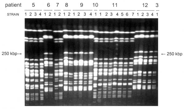 Pulsed-field gel electrophoresis of XbaI macrorestriction fragments for the ciprofloxacin-resistant Enterobacter cloacae strains. Examples of different sets of patient isolates are shown. The interpretation of these experimental data is given in Table 1. Note the minor differences, for example, among strains 11-1, 11-2, and 11-3. Not all fingerprints for the strains analyzed for each of the patients are presented. The arrows on the left and right indicate the position of the 250-k bp marker mole