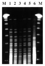 Thumbnail of Pulsed-field gel electrophoresis patterns of Vibrio cholerae isolates. DNA molecular weight markers (M lanes); V. cholerae strain isolated from water (Lane 1); V. cholerae showing isolates from patients (Lanes 2-5); V. cholerae strain 01 El Tor from the Spanish type culture collection (Lane 6).