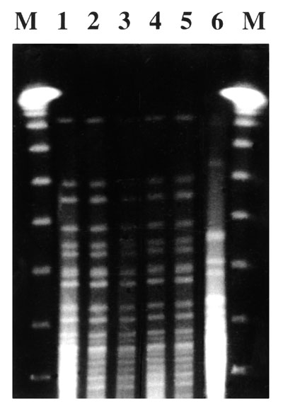 Pulsed-field gel electrophoresis patterns of Vibrio cholerae isolates. DNA molecular weight markers (M lanes); V. cholerae strain isolated from water (Lane 1); V. cholerae showing isolates from patients (Lanes 2-5); V. cholerae strain 01 El Tor from the Spanish type culture collection (Lane 6).