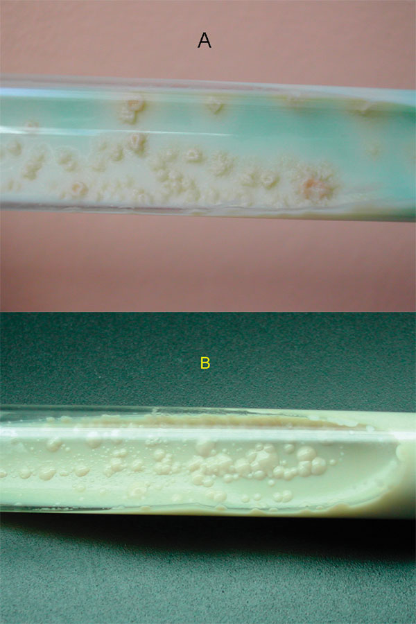 Colony morphology on Löwenstein-Jensen slants, showing M. canetti and M. tuberculosis strains. (A) Colonies of M. tuberculosis are rough, thick, wrinkled, have an irregular margin, and are faintly buff-colored. (B) M. canetti exhibits smooth, white and glossy colonies.