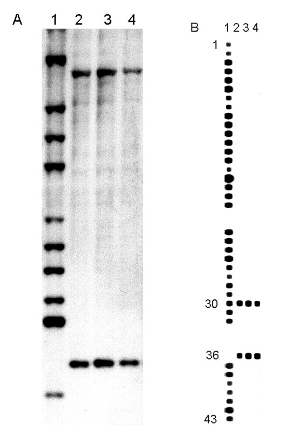 (A) IS6110 hybridization patterns of PvuII-digested genomic DNA. Lane 1, Mycobacterium tuberculosis Mt 14323 (reference strain). Lane 2, M. canetti strain NZM 217/94. Lanes 3 and 4, the strains isolated from French legionnaires with pulmonary tuberculosis (TB). (B) Spoligotyping patterns. Lane 1, M. tuberculosis H37Rv (reference strain). Lane 2, M. canetti strain NZM 217/94. Lanes 3 and 4, the strains isolated from French legionnaires with pulmonary TB.