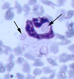 Thumbnail of Multiple morulae consistent with Ehrlichia ewingii in a neutrophil from fawn 81 experimentally injected with pooled whole blood from two wild white-tailed deer (Giemsa stain, 100X).