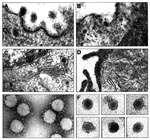Thumbnail of Electron microscopy images of thin sections and partially purified virions from cells infected with coronavirus or a virus tentatively associated with the endemic Balkan nephropathy (EBN). A and B. Electron microscopy images of thin sections of swine testicle cell infected with porcine transmissible gastroenteritis coronavirus (TGEV), showing virus binding to cell membrane at 8 h postinfection (A) or immature TGEV virions in the Golgi cisternae (C). B and D. Micrographs of thin sections of Vero cells infected with the virus tentatively associated with EBN at 12 h postinfection. B. The presence of EBN virions in the cytoplasm of the infected cells is indicated by arrows. D. Disorganization of the cytoplasmic membranous system in EBN-infected Vero cells. Electron microscopy images of concentrated TGEV (E) or EBN (F) virions negatively stained with 2% uranyl acetate. Bars in panels A–F represent 50 nm.