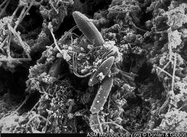 Scanning electron micrograph of a native biofilm that developed on a mild steel surface in an 8-week period in an industrial water system. Rodney Donlan and Donald Gibbon, authors. Licensed for use, American Society for Microbiology MicrobeLibrary. Available from: URL: http://www.microbelibrary.org/