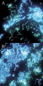 Thumbnail of Polymicrobic biofilms grown on stainless steel surfaces in a laboratory potable water biofilm reactor for 7 days, then stained with 4,6-diamidino-2-phenylindole (DAPI) and examined by epifluorescence microscopy. Bar, 20 μ.