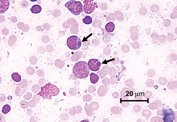 Photomicrograph of a lymphocyte from a lymph node aspirate containing Ehrlichia morula (arrow). Stain is with Wright’s-Giemsa.