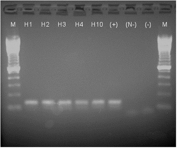 Results on 1.5% agarose gel of reverse tranferase–polymerase chain reaction (RT-PCR) products stained with ethidium bromide and imaged under UV light. M: 100-bp marker; H1–4, H10: horses 1–4 and 10; (+): positive control viral RNA, 1.8 x 102 PFU amplified; (N-): negative control for nested PCR (-); negative control from single round RT-PCR. All horse samples and the positive control show a band at the expected size (134 bp), and negative controls show only the primers (below 100 bp).