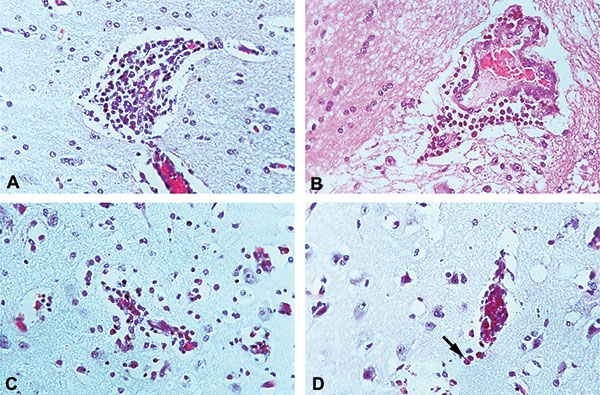 Representative histopathologic changes of brains of infected equines. A. Cerebrum, horse no. 3 (strain OAX131), showing perivascular cuff of lymphocytes (original magnification x200, hematoxylin and eosin [H&amp;E] stain). B. Cerebrum, horse no. 4 (strain CPA201), showing perivascular cuff of lymphocytes (original magnification x200, H&amp;E stain). C. Cerebral gray matter, horse no. 2 (strain OAX131), showing infiltration of mononuclear cells into brain parenchyma (original magnification x200,