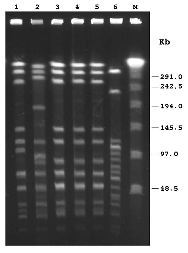 Pulsed-field gel electrophoresis patterns of ApaI-digested chromosomal DNAs of Haemophilus influenzae isolates. Lanes 1–5, H. influenzae type e (Hie) isolates, respectively, from patient nos. 1–5; lane 6, H. influenzae type b (Hib) strain belonging to one of the subclones endemic in Italy (9); M, λ ladder pulsed-field gel marker with molecular weights indicated in kilobases (kb) at the right. The isolates in lanes 3, 4, and 5 showed indistinguishable profiles (pattern 1); the isolate in lane 1 w