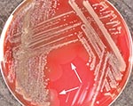 Thumbnail of Photorhabdus isolate from patient 2, growing on tryptic soy agar containing 5% sheep blood, after 48 hours’ incubation at 35°C. Arrows indicate “swarming.” The colonies could be seen to glow faintly with the naked eye under conditions of total darkness after 10 minutes of adjustment.