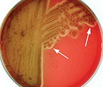 Thumbnail of Photorhabdus isolate from patient 2 after 5 days growth at room temperature on sheep blood agar. Arrows indicate the characteristic thin line of “annular” hemolysis surrounding the colonies.
