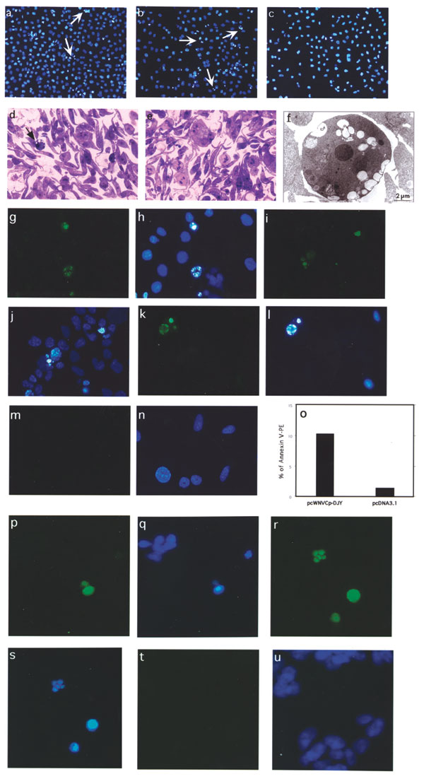 Construction and subcellular expression of West Nile virus (WNV)–NY1999 capsid (Cp) gene–expressing plasmid, pcWNV-Cp-DJY: a, Genomic organization of WNV-NY1999 (10,945 bp) is outlined based on the published (GenBank accession no. AF202541). b, Cloning strategy for WNVCp gene–expressing plasmid, pcWNV-Cp-DJY. c, In vitro translated and immunoprecipitated 35S-labeled WNV-Cp visualized by SDS-PAGE. WNV-Cp–specific protein synthesis was compared to control generated by the vector backbone pcDNA3.1 (-). d, Protein expression by Western blot analysis, of WNV-Cp expression in HeLa cells. Subcellular location of WNV-Cp protein, in HeLa cells transfected with pcWNV-CpWT (e,f) or pcWNV-Cp-DJY (g,h) plasmids. 16 h posttransfection, the cells were visualized by indirect immunofluorescence. Typical nuclear staining was observed with the cells expressing WNV-CpWT (e) compared to the cells expressing WNV-Cp-DJY (g). TUNEL assay on the WNV-Cp–transfected cells, indicating nuclear condensation (i) due to expression of capsid (j).