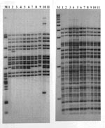 Thumbnail of Restriction fragment length polymorphism patterns of Mycobacterium tuberculosis isolates from 11 patients residing in two geographically contiguous counties, Arkansas, 1992–1998. IS6110 patterns are shown on the left and polymorphic GC-rich sequence on the right. Lane M shows M. tuberculosis strain H37Rv DNA marker (left) and 1-kb DNA ladder (right). Lane 1, isolate from patient 11; Lane 2, patient 13; Lanes 3–6, patients 4, 1, 3, and 2; Lanes 7–9, patients 10, 9, and 8; Lane 10, patient whose isolate differed by three bands and was not included in the study; and Lane 11, patient 5.