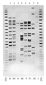 Thumbnail of Insertion sequence (IS) 6110 Southern blot hybridization patterns for major multidrug-resistant Mycobacterium tuberculosis strains, New York City, 1995-1997. STD, standard.