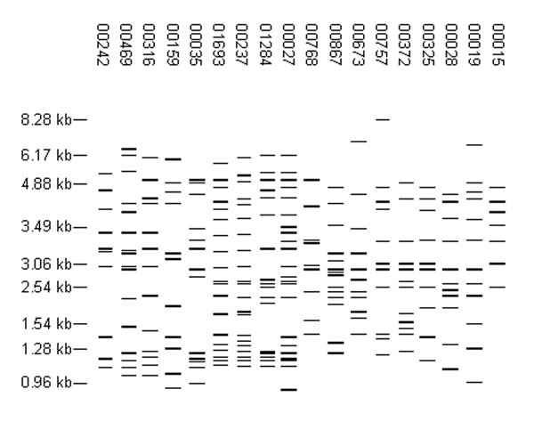 High-frequency, high-copy fingerprint patterns. Each pattern was reported for ≥20 isolates. The distribution of isolates with these patterns by sentinel surveillance site is shown in Table 2.