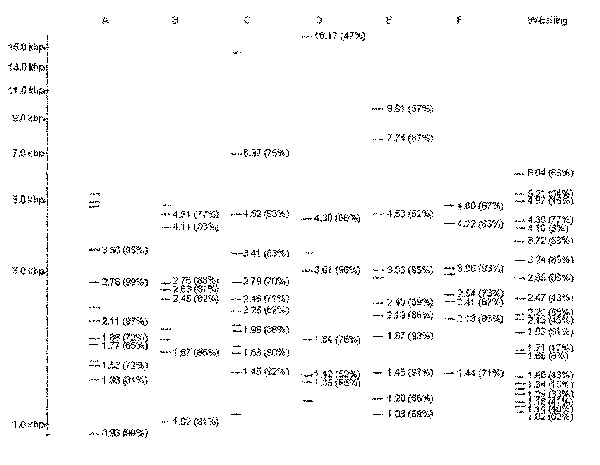 Prototype patterns for genotype sets. Set A: FP 00102; Set B: FP 04924; Set C: FP 02789; Set D: FP 02646; Set E: FP 02170; Set F: FP 04666; and W-Beijing family: FP 00237. The size of each band and the percentage of patterns in the set with each band are indicated on the pattern obtained by restriction fragment length polymorphism typing. For sets A–, only the bands common to the six prototype patterns were analyzed.