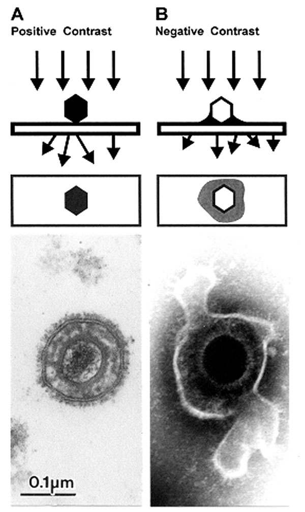 Comparison of herpesvirus appearance after positive and negative stain electron microscopic. A. Positive staining. Samples undergo a lengthy process of fixation, incubation with heavy metal ions (osmium, uranyl), dehydration, embedment, ultrathin sectioning, and staining. Chemical moieties in the object show differential affinities for the heavy metal stains, resulting in a clear outline of the viral bilayer envelope, viral envelope proteins, nucleocapsid, and the dense nucleic acid containing c