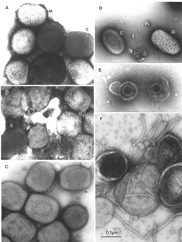 A–E. Comparison of clinically relevant viral agents associated with skin lesions. A–C show poxviruses indistinguishable in appearance from variola virus, the agent of smallpox. The slightly rounded, brick-shaped virions measure about 270 by 350 nm. Two types of particles may be seen. M, or Mulberry forms show a 10- to 20-nm diameter short-tubular or beaded surface (M). Capsular, or C forms, partly penetrated by the stain, are recognized by a 30-nm membrane (C): A. Molluscum contagiosum (mollusci