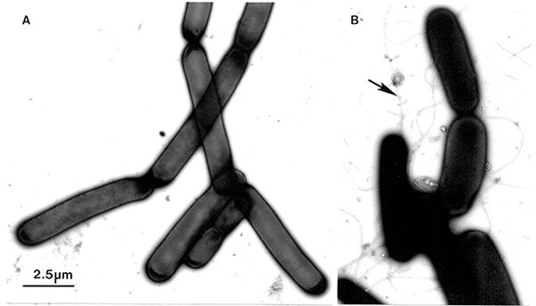 A. A colony of Bacillus anthracis was suspended, inactivated, and negatively contrasted with aqueous uranyl acetate, as described for Figure 4. The microorganisms, which grow in long chains, do not have flagella. B. The ubiquitous B. subtilis may also grow as long chains. However, in contrast to B. anthracis, the B. subtilis cells show distinct flagella (arrow). Bar = 2.5 μm.