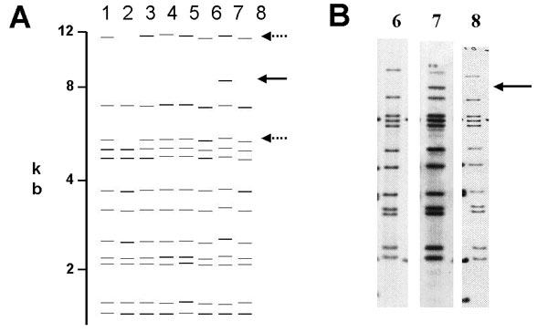 A) Computer-derived IS6110 restriction fragment length polymorphism patterns from eight laboratories for one isolate. Addition or omission of bands is demonstrated. B) Autoradiogram images demonstrating the addition of IS6110 band in restriction fragment length polymorphism pattern in one subpopulation of Mycobacterium tuberculosis isolates used in the quality assessment exercise.