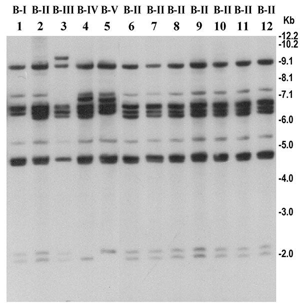 Southern hybridization analysis of rRNA genes in Vibrio cholerae O139 strains isolated from the recent epidemic and comparison with representative O139 strains isolated between 1992 and 1998. Genomic DNA was digested with BglI and probed with a 7.5-kb BamHI fragment of the Escherichia coli rRNA clone pKK3535. Lanes 1–6 represent O139 strains isolated from 1992 to 1998; lanes 6–12 represent O139 strains isolated from the recent epidemic in Bangladesh. Designated ribotypes corresponding to each restriction pattern are shown on top of the corresponding lane. Numbers indicating molecular sizes of bands correspond to 1-kb DNA ladder (Bethesda Research Laboratories, Bethesda, MD) used as molecular size markers.