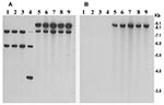 Thumbnail of Southern hybridization analysis of rstR genes in toxigenic Vibrio cholerae O139 strains isolated from the recent epidemic in Bangladesh (lanes 5–9) and in previously isolated O139 strains from 1992 to 1998 (lanes 1–4). Genomic DNA was digested with BglI and probed with the rstRET probe (A) and with the rstRCal probe (B). Numbers indicating molecular sizes of bands correspond to 1-kb DNA ladder (BRL) used as molecular size markers.