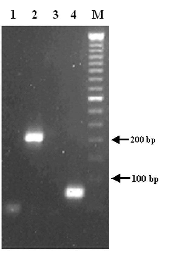 RT-PCR detection of West Nile virus RNA in cerebrospinal fluid. Lanes 1 and 3: negative controls; lanes 2 and 4: cerebrospinal fluid; lane M: 50-bp DNA ladder. Primer pairs used: lanes 1 and 2: CU9093/CL9279; lanes 3 and 4: D87F/D156R.
