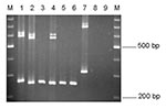 Thumbnail of EmR polymerase chain reaction products. Lane 1, Entamoeba moshkovskii Laredo; lane 2, E. moshkovskii ICDDRB:717; lanes 3–6, E. moshkovskii–positive stool DNA samples; lane 7, E. moshkovskii FIC; lane 8, E. histolytica HM-1:IMSS; and lane 9, E. dispar SAW760. M, a 100-bp DNA ladder (Promega).