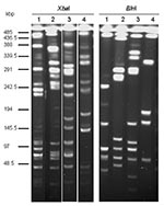 Thumbnail of Macrorestriction analysis by pulsed-field gel electrophoresis of genomic DNAs cut by XbaI or BlnI of Salmonella enterica serovar Typhimurium DT104 strain BN9181 (lanes 1), serovar Agona strain 959SA97 (lanes 2), serovar Paratyphi B strain 44 (lanes 3), and serovar Albany strain 7205.00 (lanes 4).