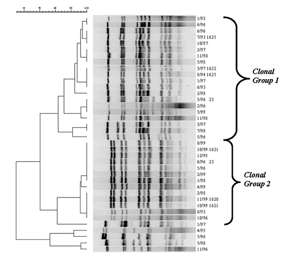 Pulsed-field gel electrophoresis patterns of meningococcal serogroup Y strains isolated from persons &gt;25 years during 1992–1999. Culture date and sequence type are listed to the right of the dendrogram.