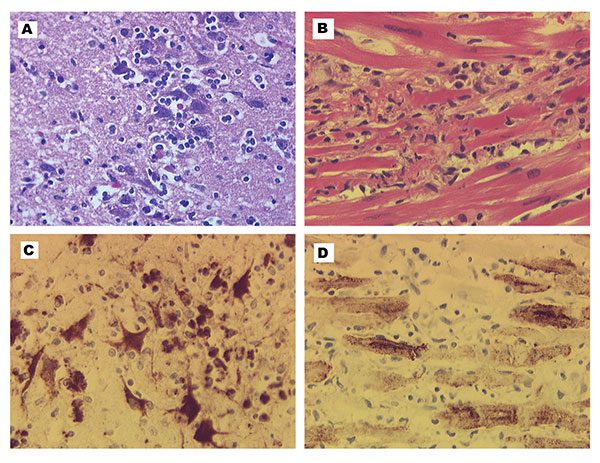 Encephalitis and myocarditis in two West Nile virus–infected canids. A, histopathology of the cerebrum of the wolf. Focus of lymphocyte infiltration and necrosis with mild gliosis; arrow indicates necrotic neuron. Hematoxylin-eosin staining. B, histopathology of the heart of the dog. Focus of leukocytic infiltration, mostly lymphocytes, and myocardial cell degeneration and necrosis. Hematoxylin-eosin staining. C, West Nile virus immunohistochemistry of the cerebrum of the wolf. Intense labeling