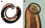 Thumbnail of Third-stage larva of Gnathostoma spinigerum. A) whole larva; B) head. (Reproduced with the permission of Pichart Uparanukraw, Department of Parasitology, Faculty of Medicine, Chiang Mai University, Thailand.)
