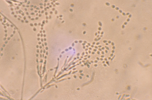 Divergent phialides and long, tangled chains of elliptical conidia borne from more complex fruiting structures characteristic of Paecilomyces lilacinus, 460X.