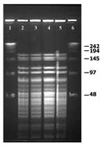 Thumbnail of Pulsed-field gel electrophoresis profiles of ApaI-digested genomic DNA of Weissella confusa clinical isolates. Lanes 1–4: Isolates from intestine, brain, spleen, and liver, respectively.