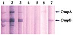 Thumbnail of Immunoblot of Rickettsia africae antigens with R. africae–positive and –negative patient serum samples. Lanes 1–3: R. africae–positive patients’ serum samples; lanes 4–5: R. africae–negative patients’ serum samples; lane 6: anti–OmpA monoclonal antibody; lane 7: anti–OmpB monoclonal antibody.