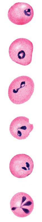 Thumbnail of Panel of computer-generated electronic images of photomicrographs of Babesia-infected erythrocytes on a Giemsa-stained smear of peripheral blood from the patient who became infected in Austria. The electronic images were edited for uniformity of color, without changing the form or size of the organisms. The image on the far right shows a tetrad (Maltese-cross form). Three glass slides of the actual blood films have been deposited in the Oberösterreichisches Landesmuseum, Biologiezen
