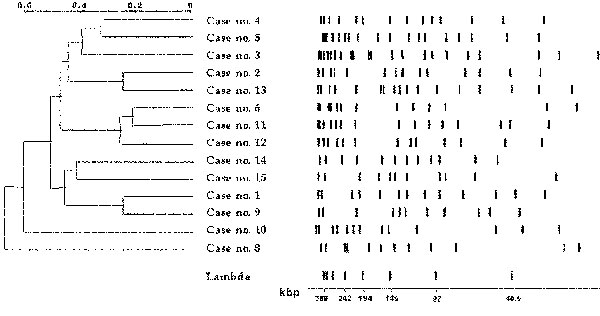 Pulsed-field gel electrophoresis analysis of DraI-digested DNA from Mycobacterium abscessus isolates. Restriction patterns of isolates from 14 patients are shown, with a dendrogram of similarity; λ concatemers were used as size standards.