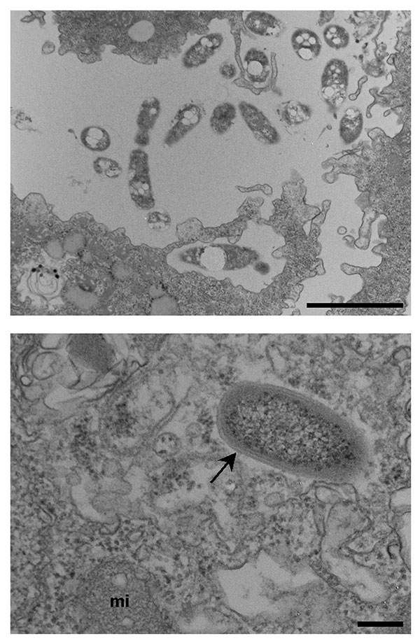 A. Bosea sp. (isolate 3) in the process of being phagocytized by Acanthamoeba polyphaga (arrows) and in the extracellular media, as seen on electron microscopy. 8,900 x magnification. Bar represents 200 nm. B. Chryseobacterium-like rod (isolate 7) within A. polyphaga (arrows), as seen on electron microscopy. Arrow show the trilammelar membrane. mi = amoebal mitochondria. 36,000 x magnification. Bar represents 200 nm.
