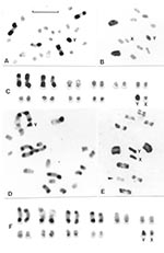 Thumbnail of Representative C-banding patterns observed in male Triatoma infestans: 2n = 22 (20 autosomes plus XY in males/ XX females) coming from non-Andean (A-C) and Andean regions (D-F). Scale bar = 10 μm. A: Spermatogonial mitotic prometaphase. This specimen from Argentina presents the lowest number of C-banded autosomes (four chromosomes). B: First meiotic metaphase. Only two heterochromatic bivalents, formed by the pairing of the four C-banded autosomes showed in 2A, are observed. The Y (