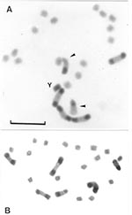 Thumbnail of Gonial mitotic prometaphases in male (A) and female (B) specimens of Triatoma infestans from non-Andean regions. Scale bar = 10 μm. A: Most common C-banding pattern detected in non-Andean region (BB BB AA). This pattern is constituted by four autosomes with a C-block in both chromosomal ends (B morph) and two chromosomes with a C-block in only one telomere (A morph) indicated by arrowheads. The Y chromosome appears C-heterochromatic. The other 14 autosomes and the X chromosome are C
