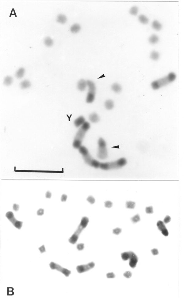Gonial mitotic prometaphases in male (A) and female (B) specimens of Triatoma infestans from non-Andean regions. Scale bar = 10 μm. A: Most common C-banding pattern detected in non-Andean region (BB BB AA). This pattern is constituted by four autosomes with a C-block in both chromosomal ends (B morph) and two chromosomes with a C-block in only one telomere (A morph) indicated by arrowheads. The Y chromosome appears C-heterochromatic. The other 14 autosomes and the X chromosome are C-negative (eu