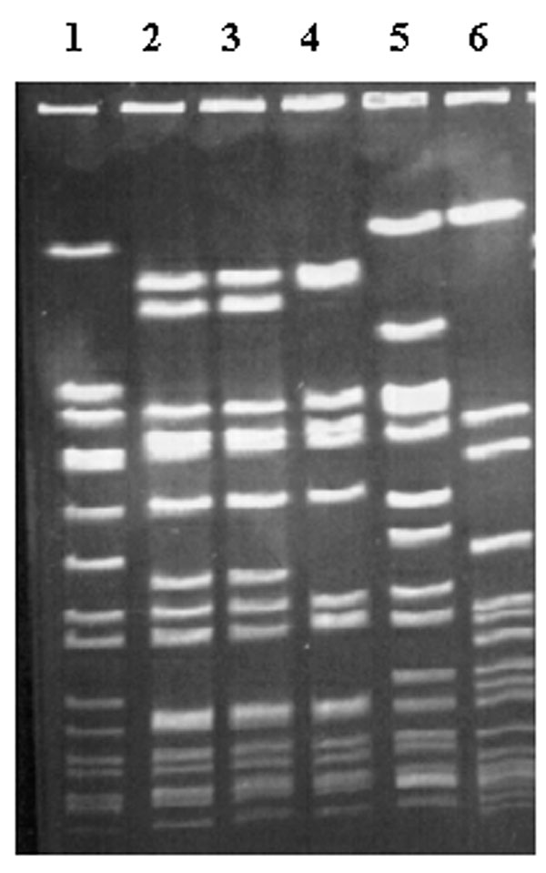 Pulsed-field gel electrophoresis of selected isolates, demonstrating predominant and secondary types. Lane 1, Staphylococcus aureus NCTC 8325, used as DNA molecular weight reference marker; lanes 2 and 3, clinical isolates of type A13; lane 4, clinical isolate of type A1; lane 5, clinical isolate of type B2; lane 6, clinical isolate of type H.