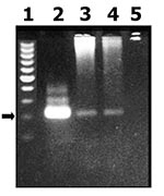 Thumbnail of Gel electrophoresis analysis of a polymerase chain reaction (PCR) product corresponding to a highly repetitive 220-bp Trypanosoma cruzi nuclear fragment. 1: molecular weight standards, 2: T . cruzi nuclear 220-bp PCR product, 3 and 4: PCR product from patients blood, 5: PCR negative control (arrows correspond to 220 bp).
