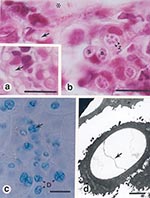 Thumbnail of a and b, histopathologic findings from infected frogs. Characteristic sporangia (s) containing zoospores (z) are visible in the epidermis (asterisk, superficial epidermis; arrow, septum within an empty sporangium; bars, 10 μm. c, Skin smear from infected frog, stained with 1:1 cotton blue and 10% aqueous potassium hydroxide (aq KOH) (D, developing stages of Batrachochytrium dendrobatidis; arrow, septum within a sporangium; bar, 10 μm. d, Electron micrograph of an empty sporangium sh