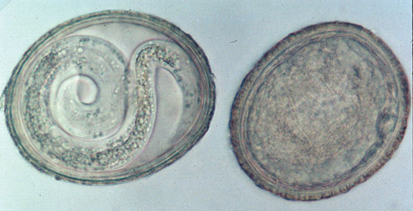 Baylisascaris procyonis eggs recovered from raccoon feces from a latrine in a playground sandbox. Left, infective egg containing a fully formed larva (40x). Right, an undeveloped or degenerate noninfective egg. B. procyonis eggs are ellipsoid, approximately 75 μm x 60 μm in size, with a brown, finely granular surface. (Reprinted from Clinical Microbiology Newsletter 2002;24:1–7; with permission from Elsevier Science.)