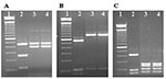 Thumbnail of Identification of Cryptosporidium muris from two stool samples from a Peruvian patient using restriction fragment length polymorphism analysis of polymerase chain reaction products with SspI (A), VspI (B) and DdeI (C). Lane 1, 100-bp molecular markers; lane 2, C. hominis control; lanes 3 and 4, C. muris from the patient.